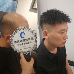 点击看大图 -唐风采假发补发定制