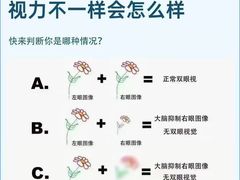 -宝视达眼镜(泌阳店)