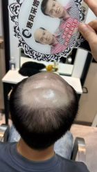 -唐风采假发补发定制