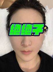 体验后-北京楚诺医疗美容