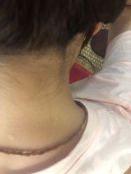 -北京美痣堂古方祛痣斑疣瘊