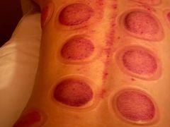 -智慧盲人按摩艾灸-颈肩腰膝疼痛调理(浦东店)