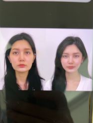 -东莞壹加壹整形美容医院
