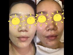 -苗方清颜痘肌研究所