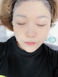 体验后-北京楚诺医疗美容