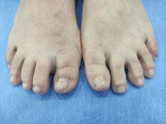 -世龙世家甲沟炎·灰指甲·嵌甲矫正·修脚(武侯区双楠店)