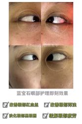 -E.beauty驻颜·痘敏肌调理中心