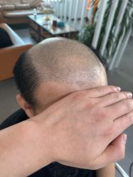 -极客侠男士假发定制补发