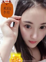 -大麦微针植发全国连锁