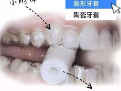 -团圆口腔·种植中心(锦江院区)