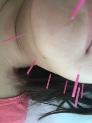 -肥三针腧穴瘦身馆