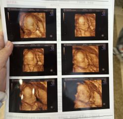 -武汉百佳妇产医院