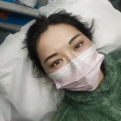 体验后-郡艺医疗美容·微整·眼鼻吸脂