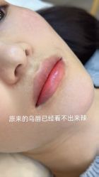 -德绣·机器野生眉发际线·美瞳线半永久