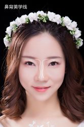 -北京米扬丽格医疗美容·联合丽格鼻整形中心