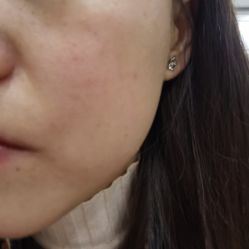 体验后-美莱医学美容医院