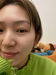 体验后-成都西区医院整形美容