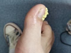 -新甲连锁灰指甲·甲沟炎·鸡眼(黑龙江路店)