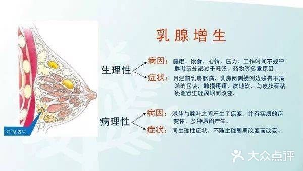 切勿长期挤乳沟 小心乳腺增生