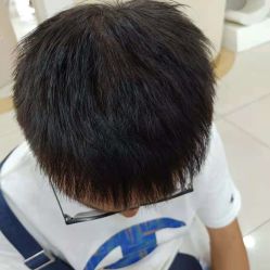 -新生植发·植养护一体