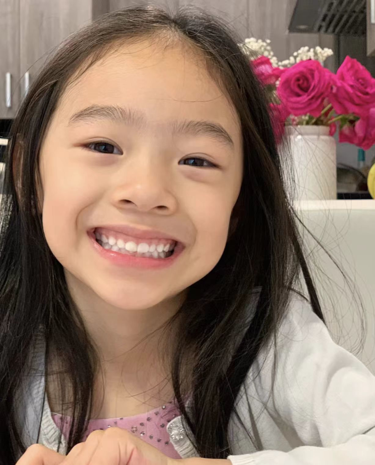 牙齿矫正#口腔#口腔医院#全网笑容最治愈女孩#牙齿保护计划#儿童牙齿