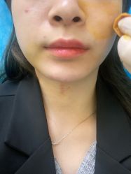 体验前-联合丽格·张菡丽格医疗美容