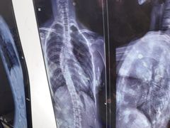-张钰强中医正骨推拿连锁(华发商都店)