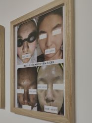 -美肤盾祛痘·问题肌头疗管理中心