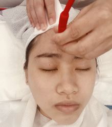 -悟空祛痘·诺奖技术专业店