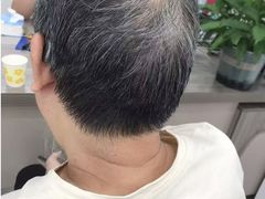 -自然之声助听器(平凉店)