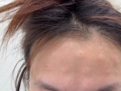 体验前-杭州奥拉克医疗美容门诊部