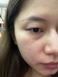体验后-广东韩妃整形外科医院