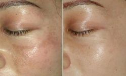 -SKINIST丽铂医疗美容