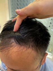 -雍禾植发全国连锁