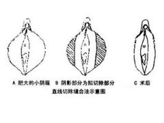 -成都恒博医院·全科检查