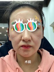 -美莱医学美容医院