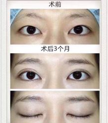 -上海漾颜医疗美容