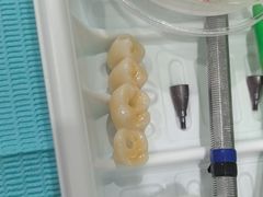 -上海仁爱医院口腔科 · 种植