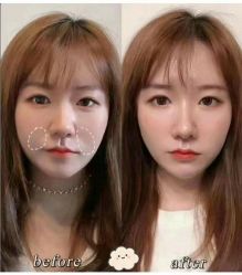 -Yestar 嘉兴艺星医疗美容医院