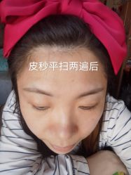 体验后-上海玫瑰医疗美容医院