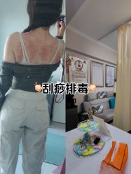 -苗塑堂减肥艾灸