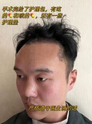 -雍禾植发全国连锁