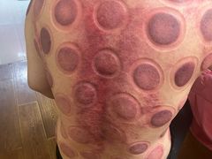 -沈师傅盲人按摩工作室(密三小区店)