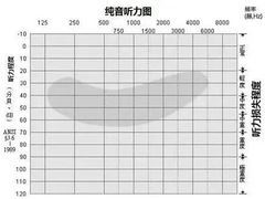 -安湃声助听器(同仁医院店)