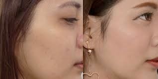 -SKINIST丽铂医疗美容