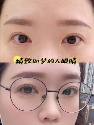 -宥莉·ULLY 痘敏肌•科技皮肤管理中心