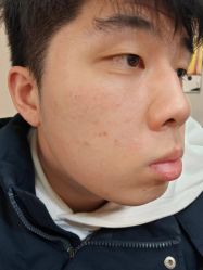 -北京美痣堂古方祛痣斑疣瘊