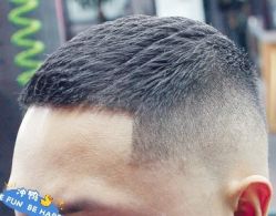 -大麦微针植发丨全国连锁