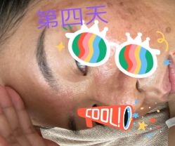 体验后-广州美莱医疗美容医院