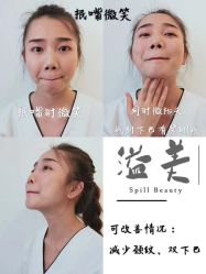 -溢美古法抗衰